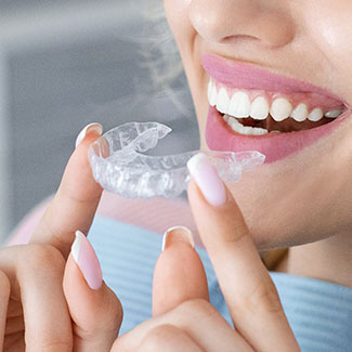 Woman inserting Invisalign clear aligner