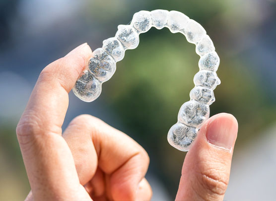 Invisalign clear aligner